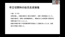 修練医の先生に共有したい産婦人科基本手術における経験（山口綾香先生）