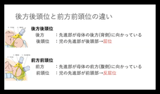 子宮口全開大時における回旋異常（OP）のマネジメント：超音波評価と介入戦略（ 川村洋介先生）